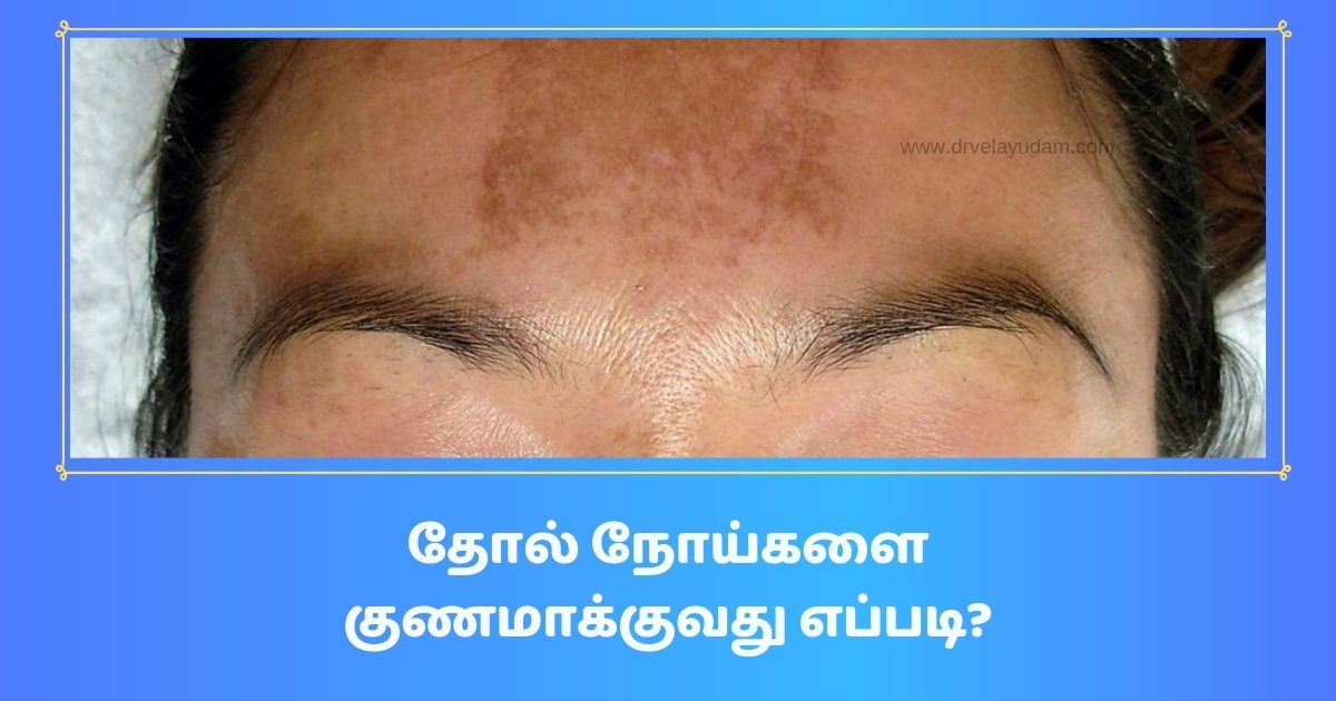 Skin-Disease-Siddha-Treatment-1200x630.jpg